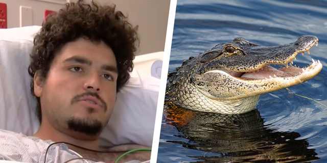 &quot;It's Not The End Of The World&quot; Florida Man Whose Arm Was Bitten Off By Alligator Speaks Out!